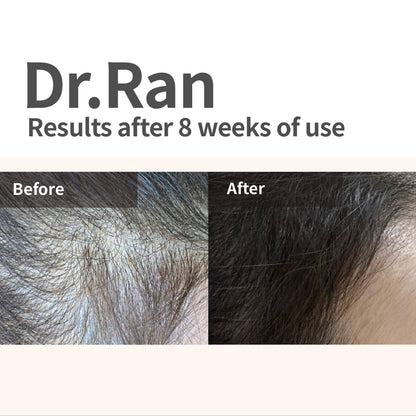 [H'ar x Seapuri] Doctor Care Hair Loss & Scalp Nutrition Trio | Dr. Ran x1 + Dr. Mori N x1 + Dr.33 x1