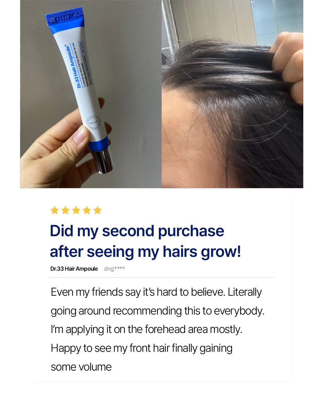 Customer sharing a 5-star review for Dr.33 Hair Ampoule after seeing noticeable hair growth, holding the product and showing improved hair volume in the forehead area.